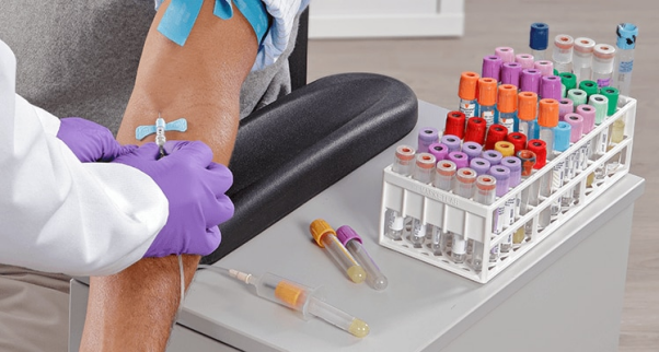Ketahui Tentang Vacutainer, Tabung Pengumpul Darah 2 |