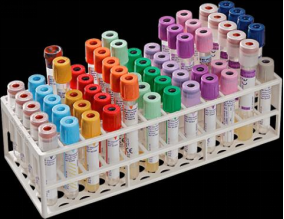 Ketahui Tentang Vacutainer, Tabung Pengumpul Darah 3 |