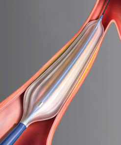 Ultraverse PTA Dilatation Catheter