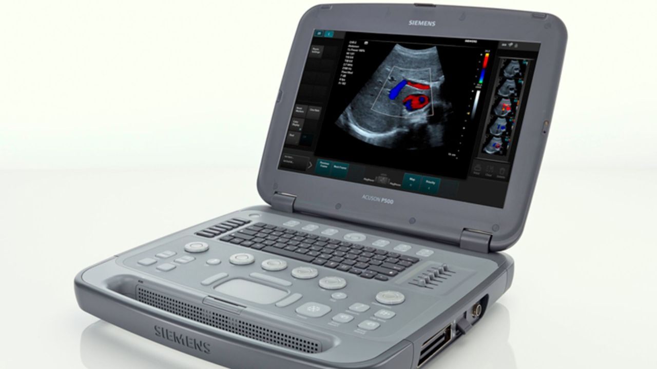 acuson-p500-frosk-portable-ultrasound-02013829_10-06588509_10 |
