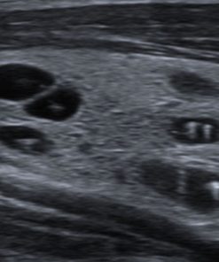 Siemens Acuson P500 Ultrasound Portable 2 Probes 7 |