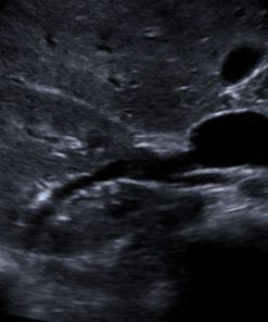 Siemens Acuson P500 Ultrasound Portable 2 Probes 5 |