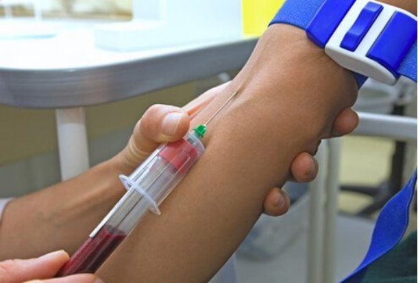 Tabung ESR: Pemeriksaan Laju Sedimentasi Eritrosit Lengkap 1 |