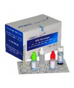 FOKUS Anti Streptolysin – O (ASO) Latex Test