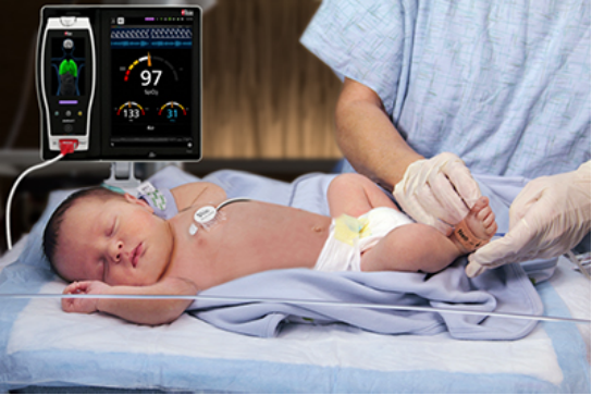 Jenis Monitor Elektrokardiogram untuk Pemantauan Jantung Anak 2 |