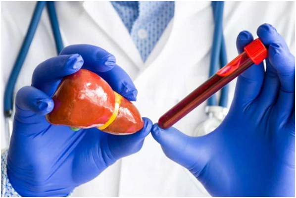 diagnosis penyakit hepatitis