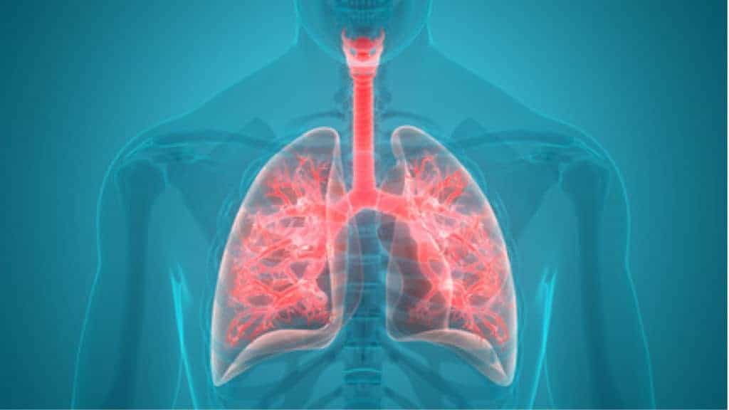 KETAHUI EFEK SAMPING MENGGUNAKAN VENTILATOR MEKANIK