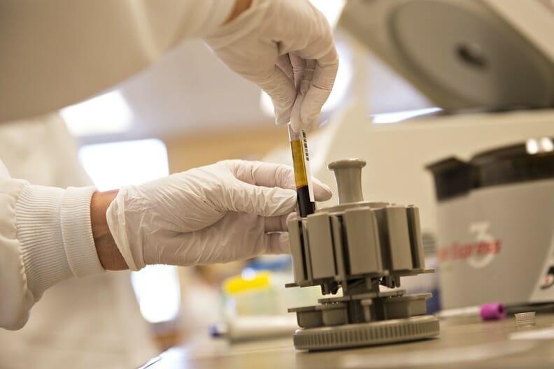 KERUSAKAN PADA URINE ANALYZER DAN CARA MEMPERBAIKI SENSOR YANG ERROR