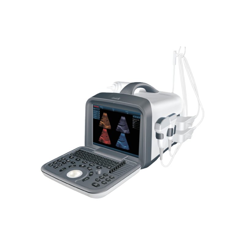 SEWA ICU USG PORTABLE 2D ZONCARE ZQ-6602 1 SEWA ICU USG PORTABLE 2D ZONCARE ZQ-6602