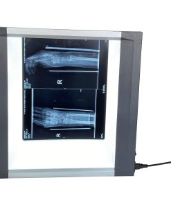 Nesco X-ray viewer, MST – 4000I (Single Panel)