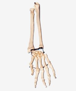 GENERAL DOCTOR GD/A11125 Tulang Telapak Tangan dengan Tulang Siku dan Tulang Radial