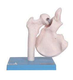 GENERAL DOCTOR GD/A11201/4 Model Sendi Pinggul