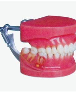 GENERAL DOCTOR Model Demonstrasi Penyakit Periodontal GD/B10032