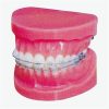 Model Ortodontik Cekat GD/B10036 - Braket Keramik Transparan 2 |