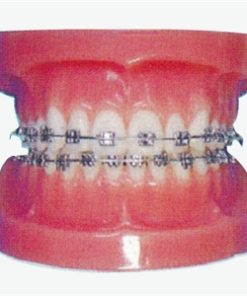 GENERAL DOCTOR GD/B10037 Model Ortodontik Cekat (Normal)
