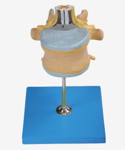 GENERAL DOCTOR GD/A18107 Vertebra Lumbar dengan Sumsum Tulang Belakang dan Saraf Cauda Equina