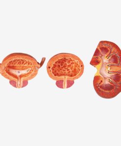 GENERAL DOCTOR Sistem Kemih GD/A14004