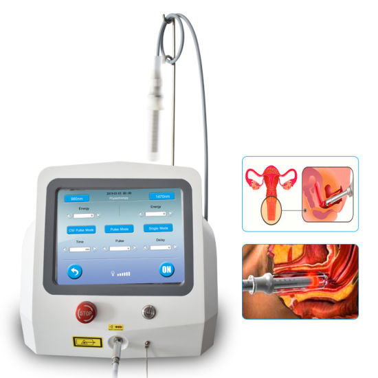 ALAT VELAS GYNECOLOGY LASER