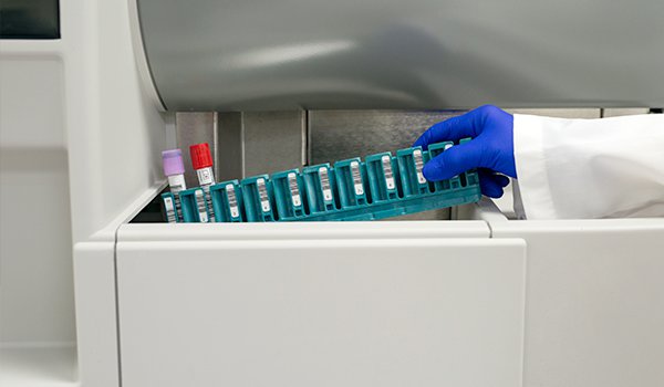 CARA MERAWAT HEMATOLOGY ANALYZER DAN KELEBIHANNYA