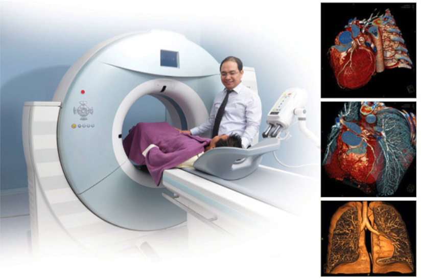DIAGNOSIS PENYAKIT LEBIH AKURAT DENGAN ADANYA FITUR SLICE CT SCANNER 1 DIAGNOSIS PENYAKIT LEBIH AKURAT DENGAN ADANYA FITUR SLICE CT SCANNER