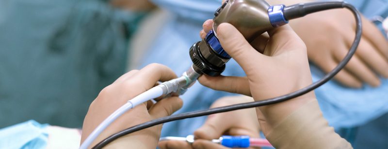 KETAHUI TENTANG FITUR DAN FUNGSI VIDEO ENDOSCOPE