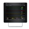 Patient Monitor BeneVision N19 Premium Mindray | Tanda Vital 1 |