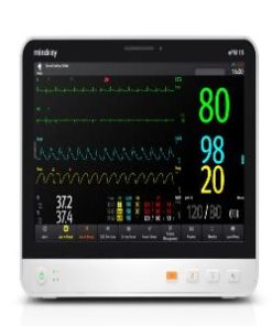 MINDRAY EPM 15 PATIENT MONITOR - ADVANCE