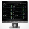 Mindray BeneVision CMS Standard - Monitor Jantung Presisi