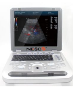 NESCO Color Doppler Ultrasound Diagnostic System, 3D/4D, NS-1700B