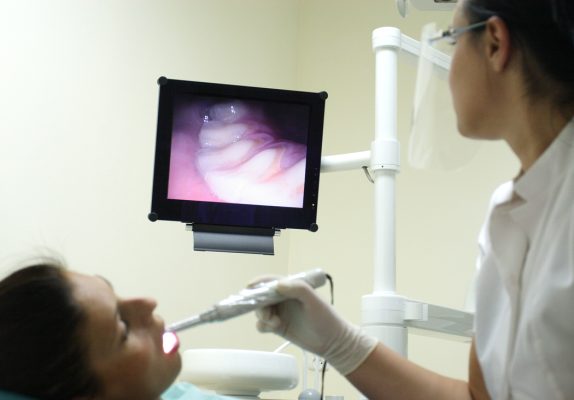 DENTAL INTRA-ORAL CAMERA