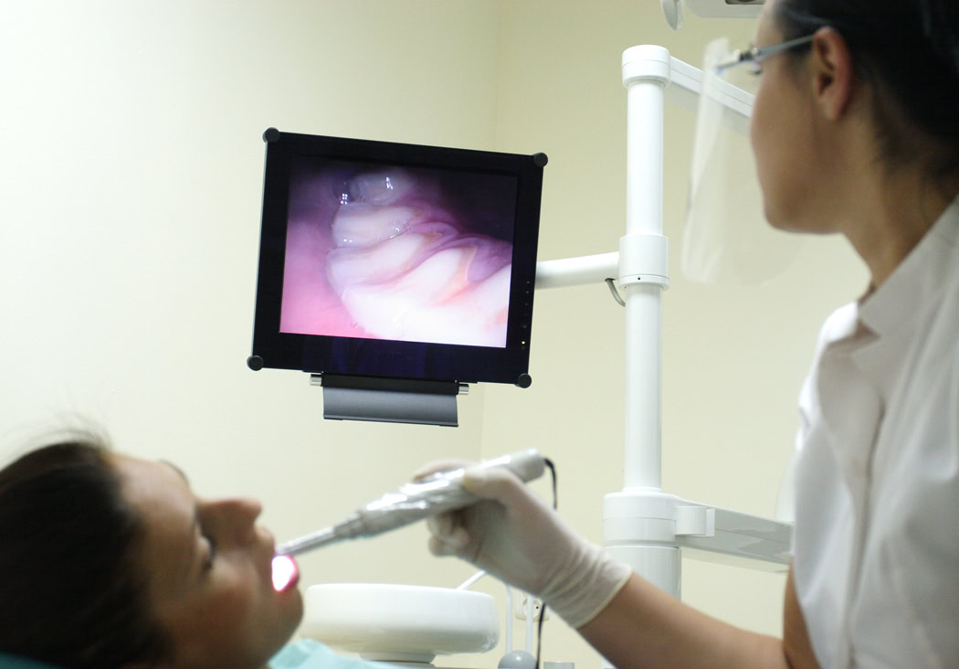 DENTAL INTRA-ORAL CAMERA