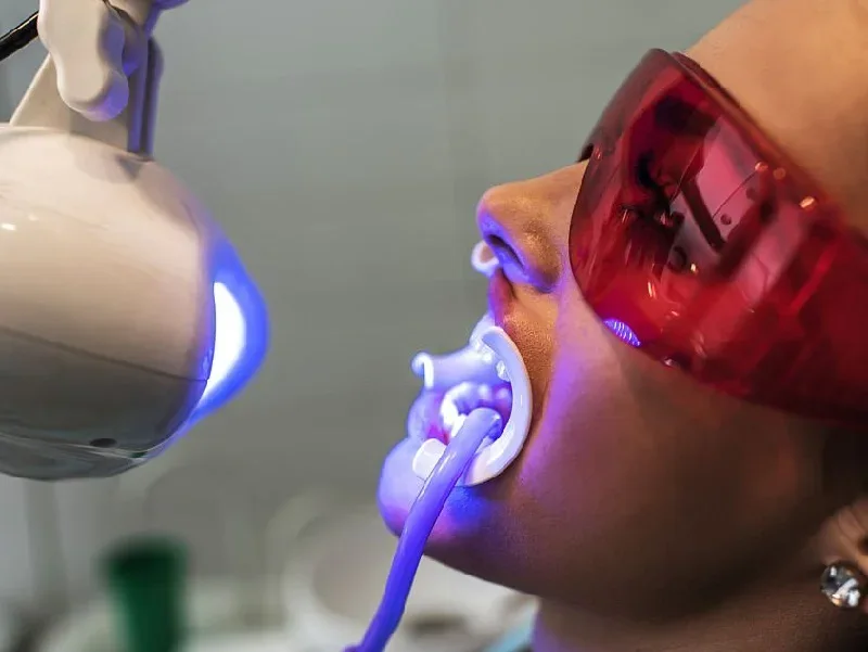RAHASIA KILAU SENYUMAN: FITUR HIGH QUALITY TEETH WHITENING LIGHT MACHINE