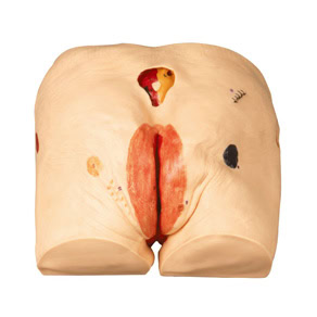 KETAHUI TENTANG GD/H90E DECUBITUS ULCER CARE SIMULATOR