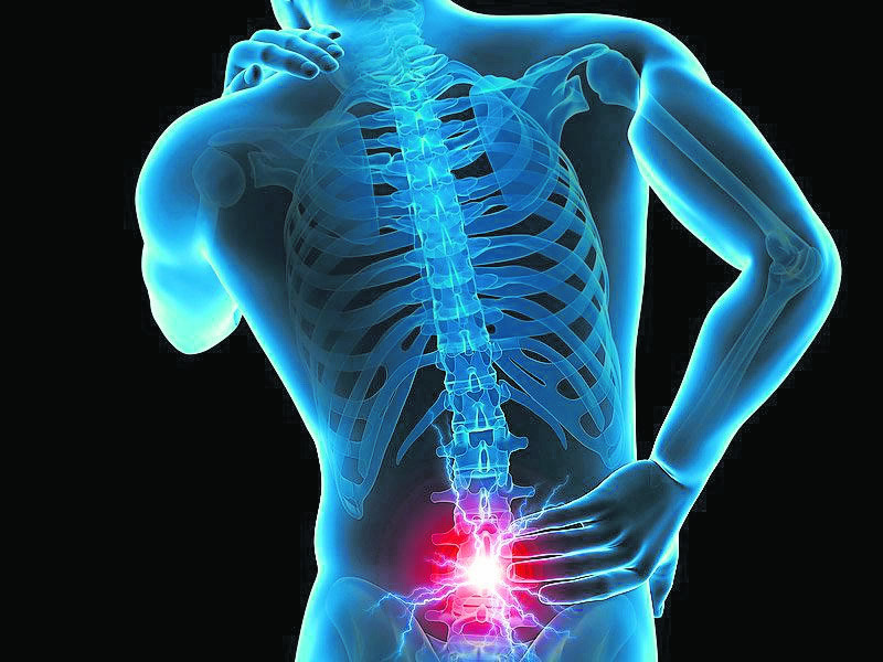 PROSEDUR LASER PERCUTANEOUS DISC DECOMPRESSION (LPDD) SEBAGAI PENANGANAN SARAF KEJEPIT