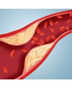 Lipid Profile