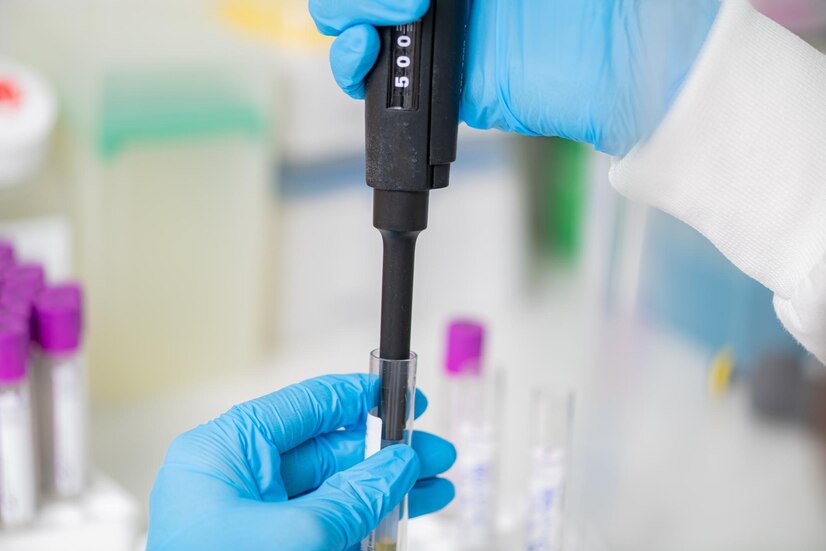 KETAHUI TENTANG KEUNGGULAN ALAT MICROPIPETTE