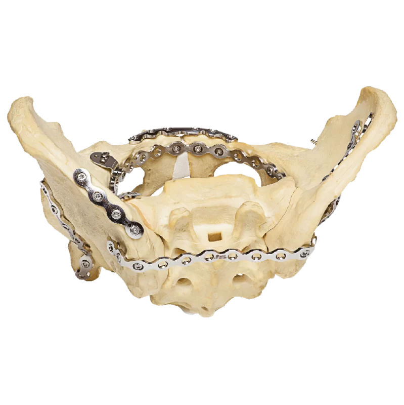 BONE PLATE - ROUNDED PELVIC RECONSTRUCTION PLATE - 6, 7, 8, 9, 10 HOLES