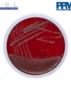 ABL - PPM (Prepare Plate Media) DAN LOGO Blood Agar Base