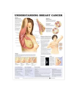 GAUMARD Memahami Kanker Payudara (C180)