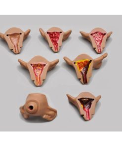 GAUMARD Paket Patologi Internal Rahim dengan Normal dan Abnormal (S504.2)