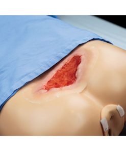 GAUMARD Kit Luka Ulkus Dekubitus (WK145)