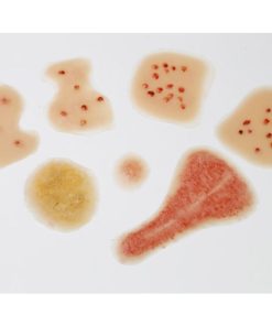 GAUMARD Kit Luka Kulit/Ruam Bayi Baru Lahir (WK160)