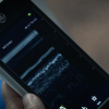 GE Vscan Extend™ Lung M-Mode App 2 |