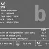 GE Volpara® Density 1 |