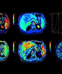 GE CT Perfusion 4D