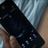 GE Vscan Extend™ Auto Optimize App 2 |