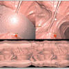 GE Advantage CTC Pro3D 2 |