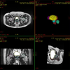 GE AdvantageSim MD 2 |