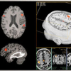 GE BrainWave fMRI: Teknologi Pencitraan Otak Revolusioner 1 |