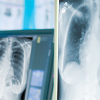 GE ClearRead™ Xray